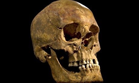 Richard III skull