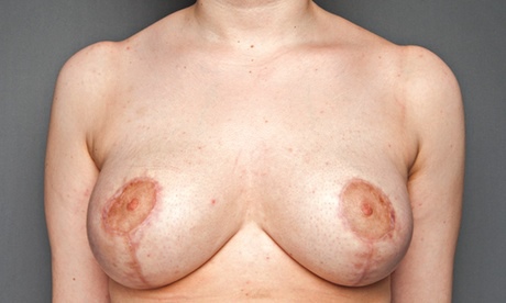 breasts: 19-year-old