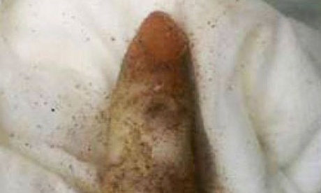 Darwin 'finger'