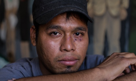 Omar Garcia, 24 was called to the scene by Alonso and collected evidence.