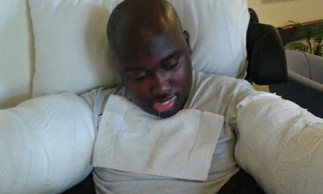 Julian Cole after his injuries