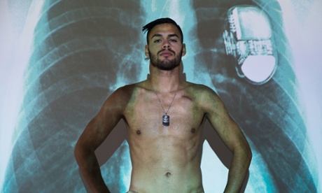Sport picture of the day: x-ray vision