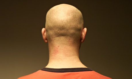 man with bald head
