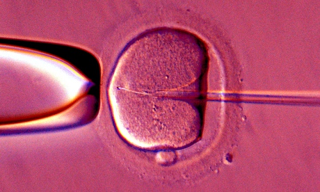 artificial insemination of human female egg
