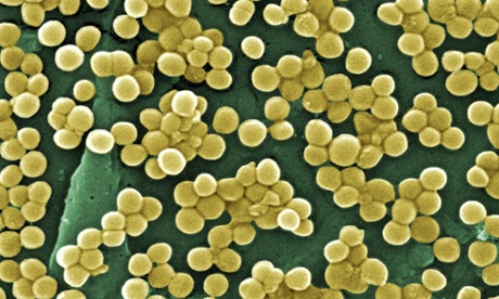 New class of antibiotic could turn the tables in battle against superbugs