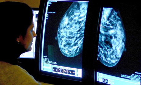 Dual drug fights breast cancer