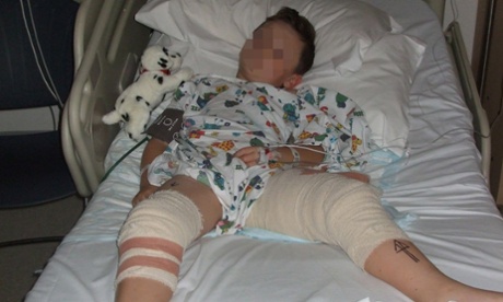 Photograph issued by Greater Manchester police of seven-year-old Christian Hickey in his hospital bed.