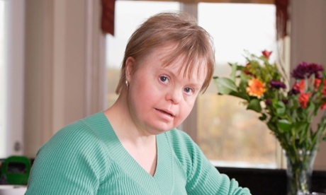 woman with down's syndrome