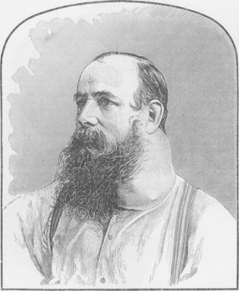 Mr B and his massive tumour