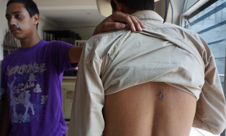 Two of seven men alleging in contested court proceedings they were shot by security personnel contracted by Canada-incorporated company Tahoe Resources during a protest against the Escobal mine in Guatemala. The men say they were shot 