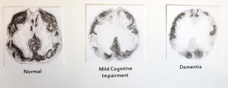 Sketches of brain imagery