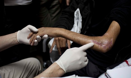 Graeme Groom, a consultant orthopaedic surgeon from King's College Hospital in London, examines Abdullah.