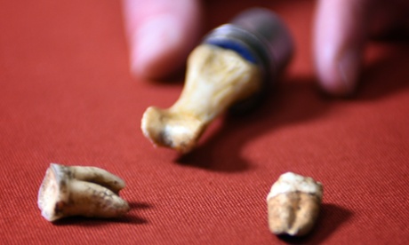 Two molars and a thumb bone belonging to King John