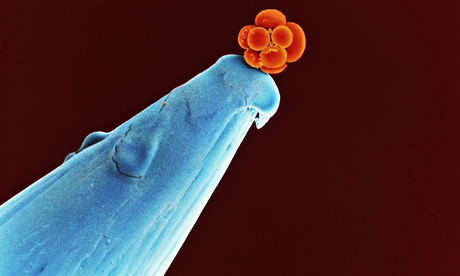  Human embryo on a pin