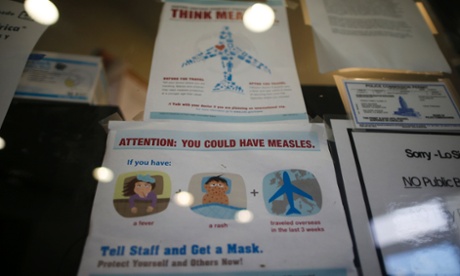 measles signs