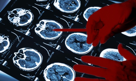 Doctor's hands examining brain scan