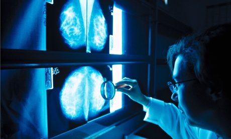 A doctor looking at mammograms.