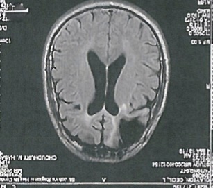 clayton brain scan