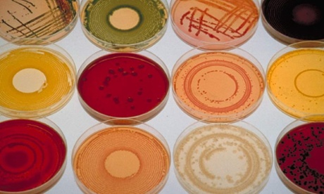 Various bacterial cultures in petri dishes 