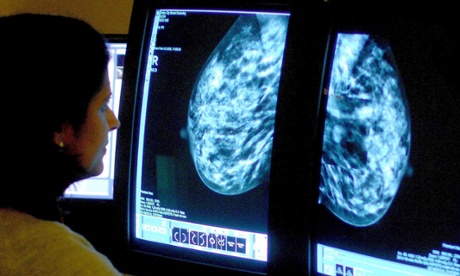 mammogram