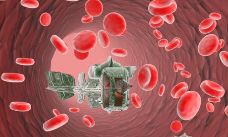 Remote control of brain activity with heated nanoparticles