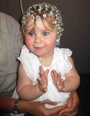 Electroencephalography