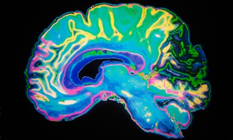 Artificially coloured MRI scan of the human brain