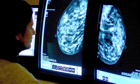 A consultant analyses a mammogram