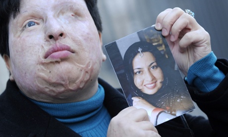 Ameneh Bahrami holds a photo showing herself before she was blinded with acid by Majid Movahedi.