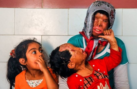 Somayeh Mehri has died after struggling with a respiratory problem caused by an acid attack. Her daughter, Rana, who was also a victim, survives. 