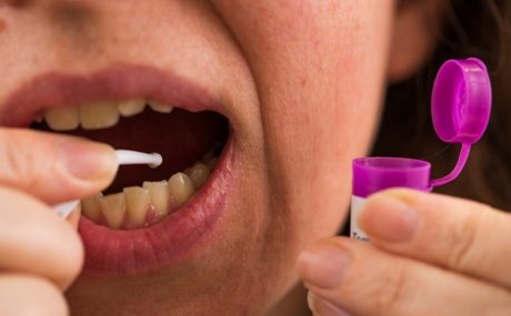 Home dental treatment. Picture posed by a model.