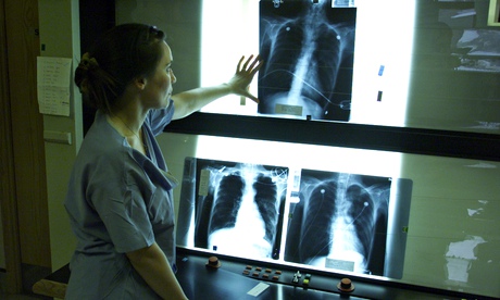 Middlesex hospital, Euston looking at x-rays