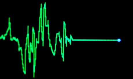 Heart Rate Monitor, Flatlining