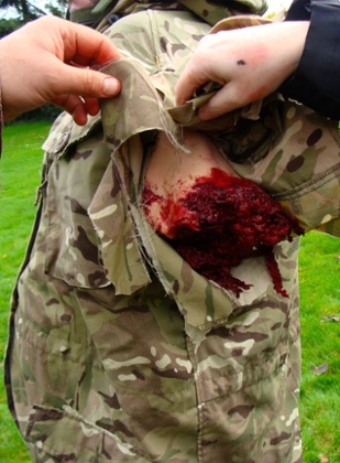 A simulated limb amputation by Magnum Services