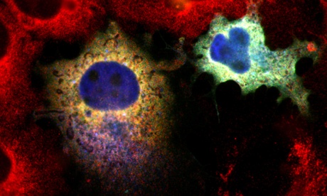 Silhouettes of mitochondria. Harmful mutations in mitochondrial DNA can cause diseases affecting the heart, brain and muscles. 