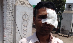 The Guardian spoke to Rupak Aryal as he was discharged from Bir Hospital.