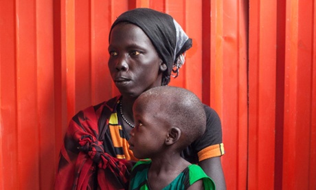 A woman and her malnourished child wait to receive treatment at the Leer Hospital, South Sudan