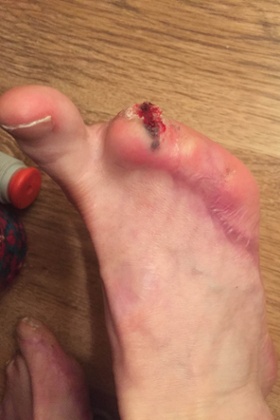 Kim Lo’s feet now.