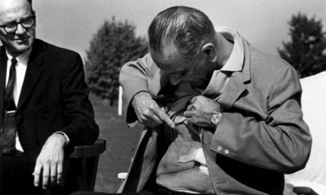 Lyndon Johnson shows Gall bladder surgery scar