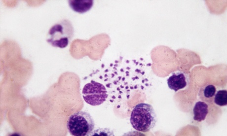 Leishmaniasis: bone marrow smear.