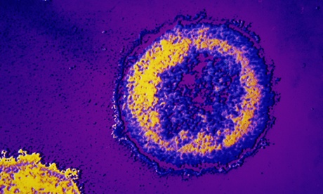 A microscopic HIV virus.