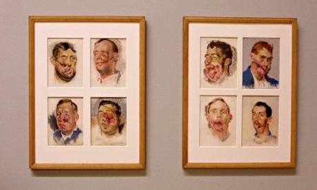 Human cost …  soldiers depicted by Henry Tonks.