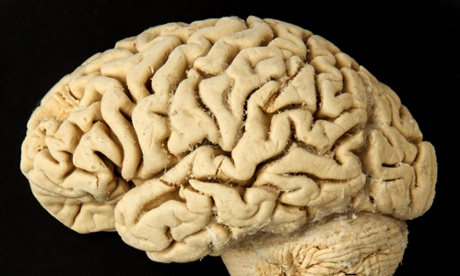 A brain