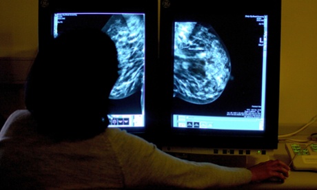 A consultant studying a mammogram