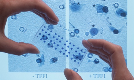 Cancer cell research 