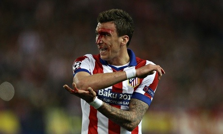 Mario Mandzukic 
