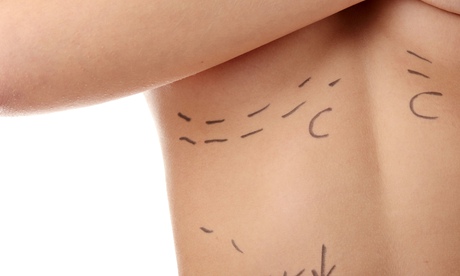 Woman ready for cosmetic surgery