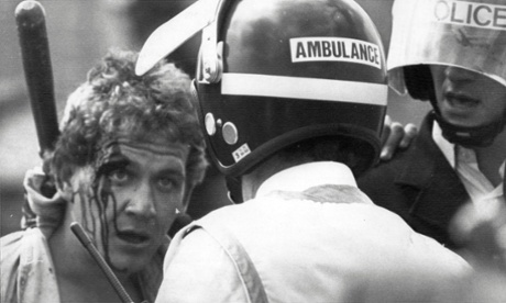 An injured picket at Orgreave.