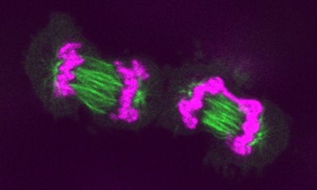 Microtubules in action during chromosome division. (© Iva Tolić).