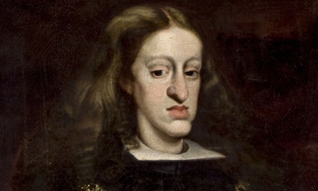 Doomed by greed: the last Habsburg, Charles II of Spain, and his prognathous jaw. 